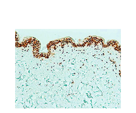 Thymine Dimer